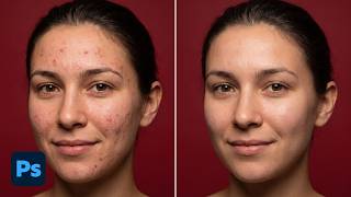 Remove Acne & Blemishes in Seconds with Photoshop AI screenshot 5