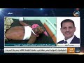 نشرة أخبار الخامسة مساءً | وفاة الفنان العدني أنور مبارك بعد صراع مع المرض (9 مارس) نشرة أخبار الخامسة مساءً | وفاة الفنان العدني أنور مبارك بعد صراع مع المرض (9 مارس)