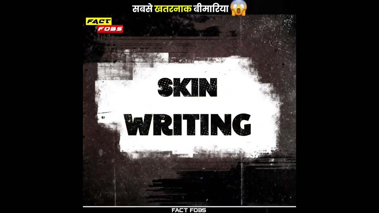 सबसे खतरनाक बीमारिया 😱🤯 | #shorts #shortfacts