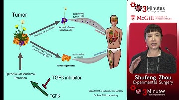 Shufeng Zhou: Circulating tumor cells