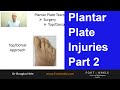 Plantar Plate Injuries - Part 2 | Seattle Podiatrist