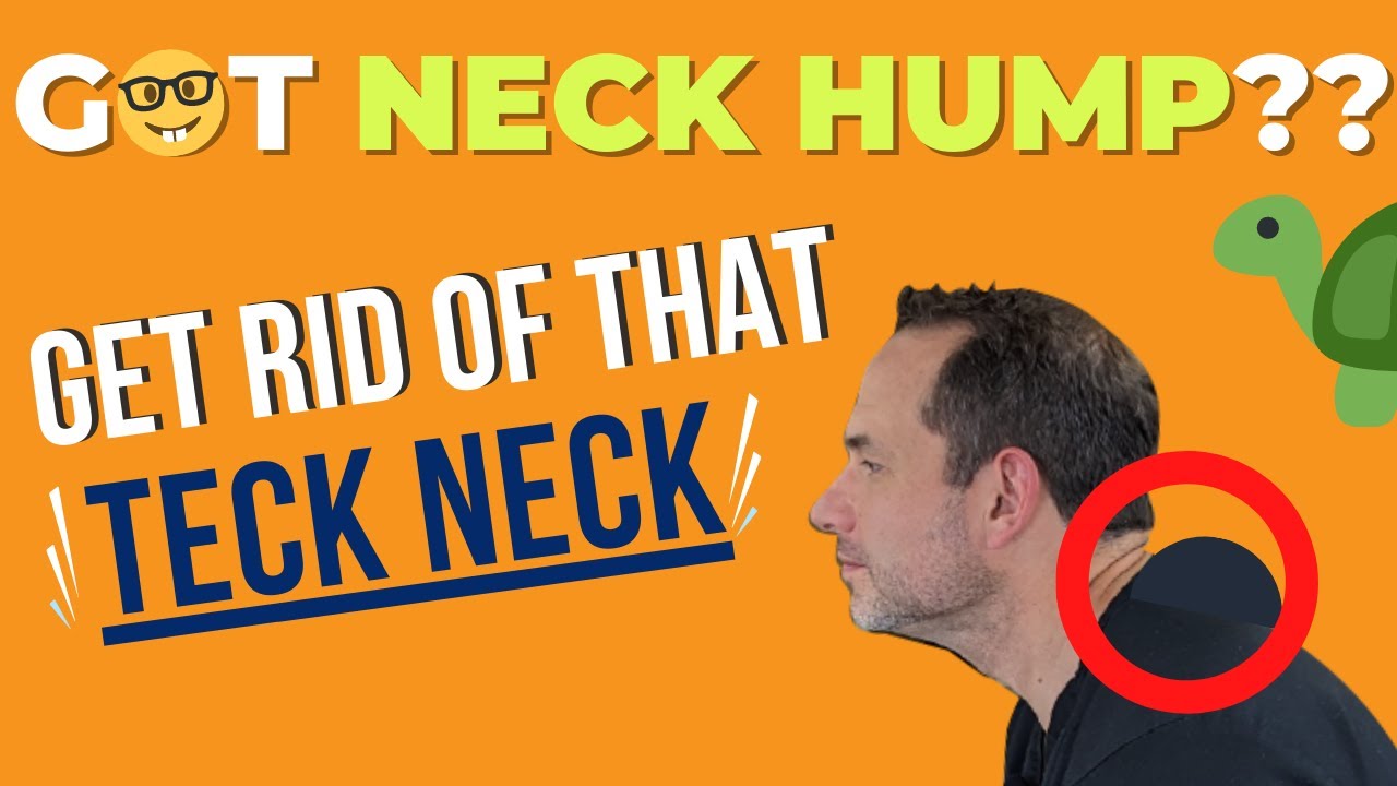2 BEST Exercises for Neck Hump! 😳 techneck trythisout YouTube
