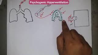 PSYCHOGENIC HYPERVENTILATION