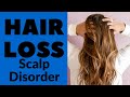 Hair Loss Scalp Disorder - Scalp Disorders That Cause Hair Loss -  Alopecia