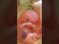 #shorts#pregnancy #amniotic fluid and pregnancy