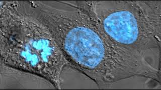 Nucleus (biology) | Wikipedia audio article
