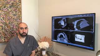 KaVo (Dexis) OP3D with Dr. Angelos Sourial and Daniel Roberts