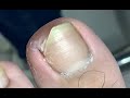 Best nail nail method