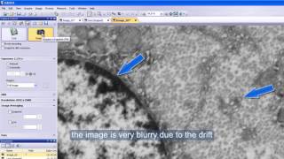 Drift Correction with RADIUS