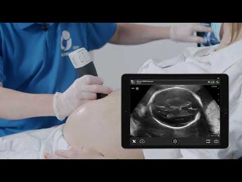 Video: Berapa bpd normal pada kehamilan di MM?