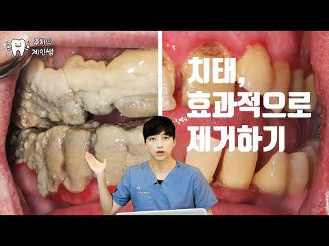 가그린? 워터픽? 실험영상으로 알려드립니다 |  구강관리용품 효과 총정리  | 잇몸관리 잘해서 치과가지 않는 방법