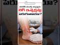 Can Varicose Veins Cause Frequent Infections? | Dr. Soujanya | Avis Hospitals