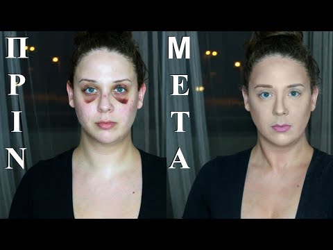 Πως Να Καλύψετε Μελανιές | AnotherMakeupWorld