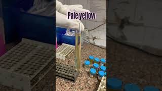 Analysis of urine based on color 🧪 save it before clinical posting .#healthcare #medical #shorts