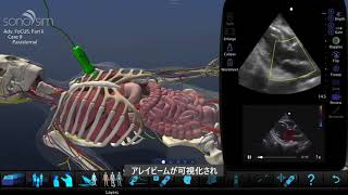 SonoSim® Starter Edition 超音波検査トレーニングシステム