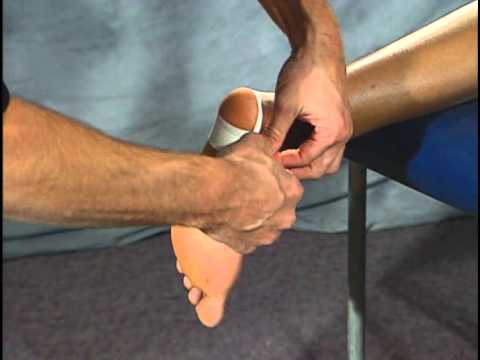 Bruised heel - YouTube