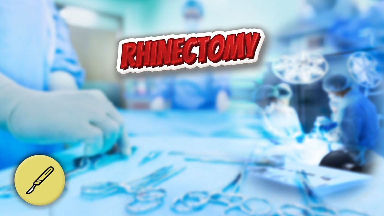 Rhinectomy - Everything Surgeries 😬⁉️ - YouTube
