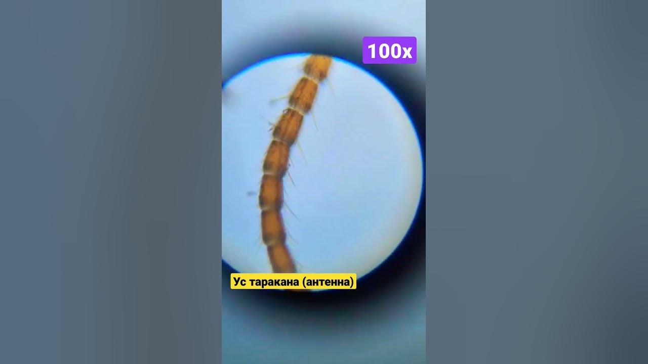 Как выглядит таракан под микроскопом Pin by Lynne Macintyre on Bugs Cat fleas, Electron microscope, Insect photograph