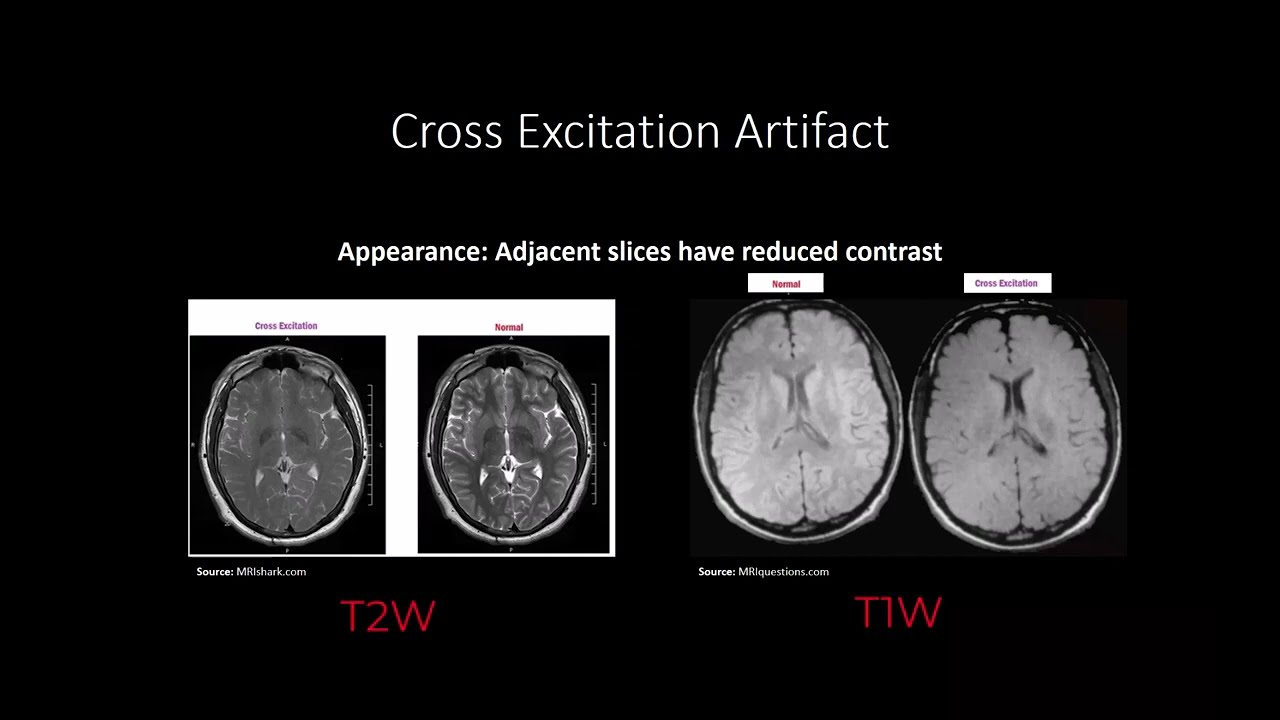 MRI Artifacts and their Compensation