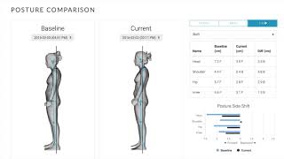 3D Body Scanning - Postural Assessment Software (PAS) - Fit3D screenshot 4