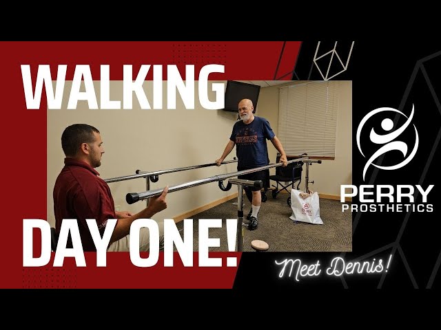 Amputee Walking Success: Dennis