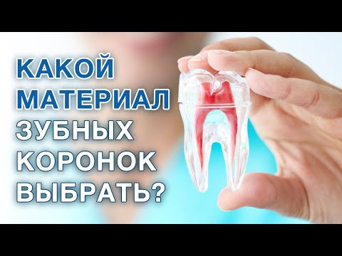 Какой материал коронок и мостов выбрать? / Лучшие зубные коронки и мосты / Безметалловые коронки