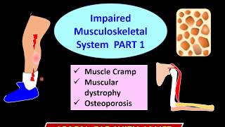 Biology Form 5  Chapter 2 (2.1) Impaired Musculoskeletal System Part 1