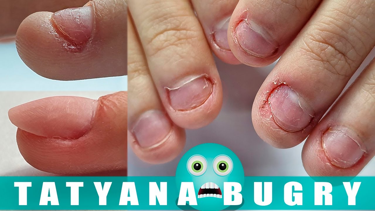 9 Ways to Stop Biting Your Nails Once and for All  How to Stop Biting Your  Nails