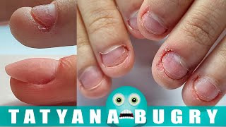 Transformation On EXTREMELY Bitten Nails | Fixing Bitten Nails With Polygel | Russian ,Efile Mani