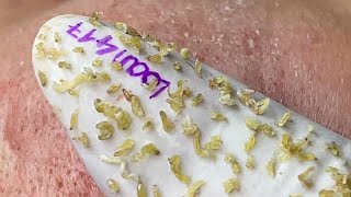 Satisfying With Loan Nguyen Spa Video #011