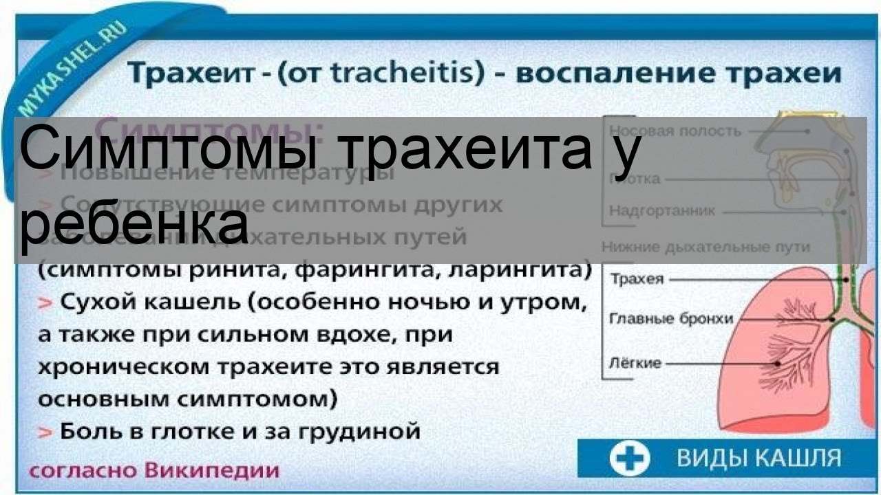 Русский пор на син трахеит мате