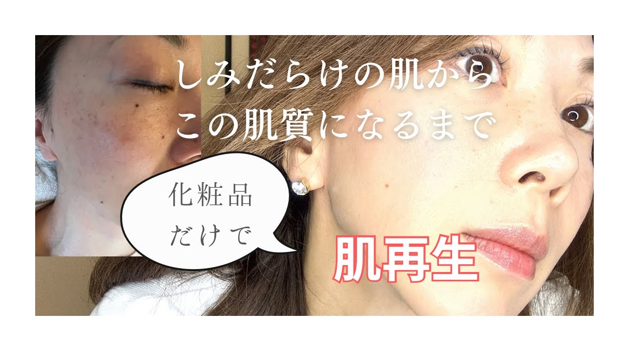 ピュールボーテ化粧品だけで肌再生していく 期間や金額 やり方など総