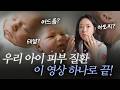 아토피일까 봐 밤잠 설친 엄마들 필독!ㅣ피부과 전문의 엄마의 꿀팁