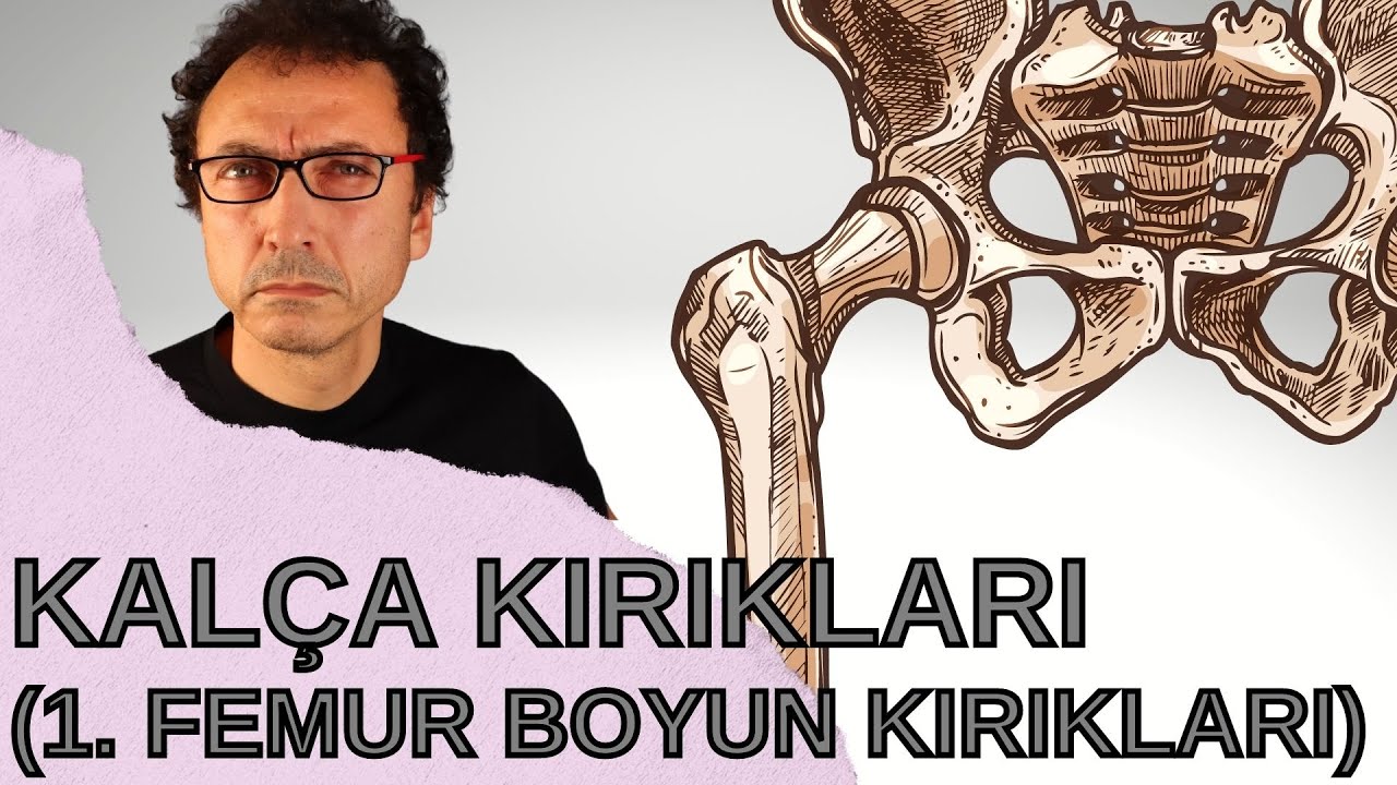 Kalça Kırıkları (1. Femur Boyun Kırıkları)