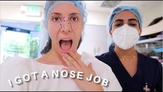 I GOT A NOSE JOB!!!