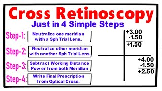 Cross Retinoscopy just in 4 Simple Steps