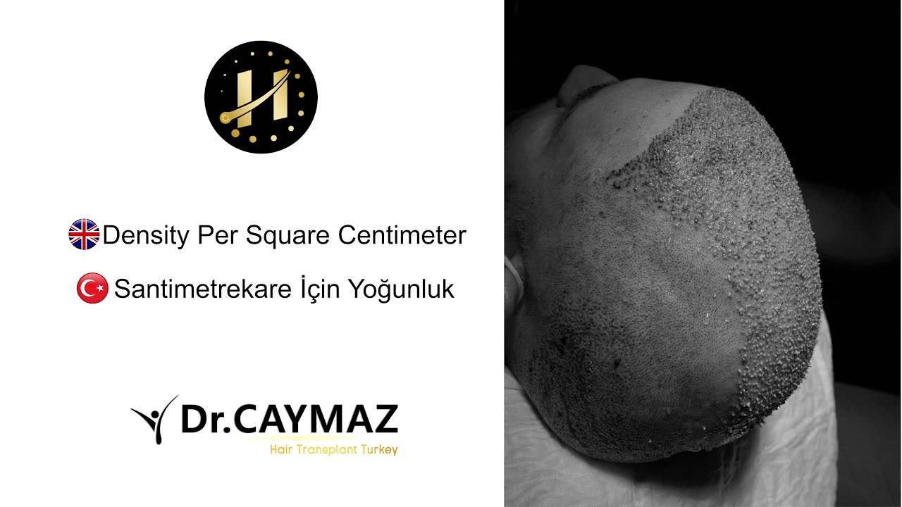 How many hair grafts are in a square centimeters?