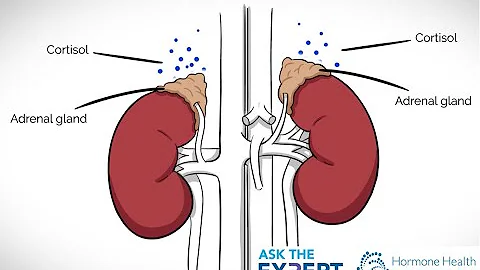 Ask The Expert -Truth About Adrenal Fatigue