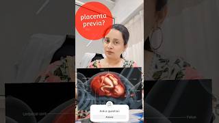 Placenta previa and bleeding  #pregnancy #conceive #parenting #pcos