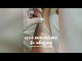 Legs skin peeling | so satisfying 👌