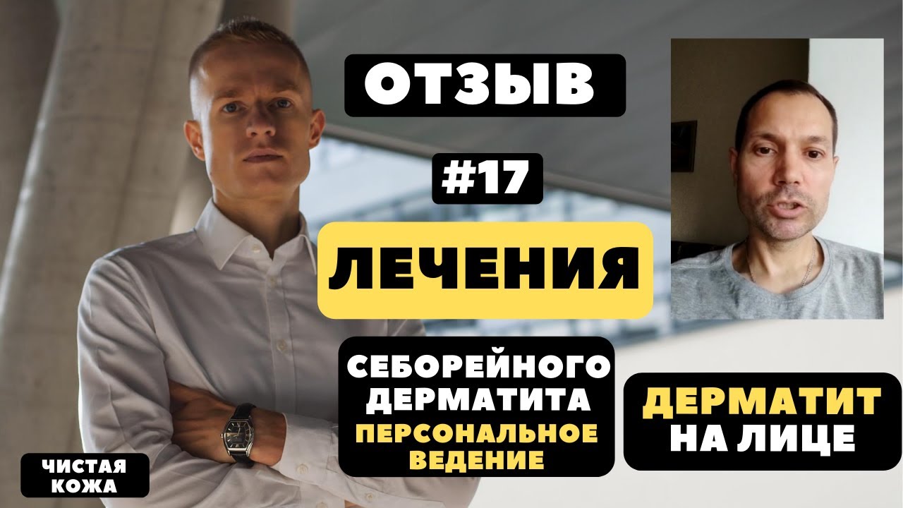 Отзыв #17 СЕБОРЕЙНЫЙ ДЕРМАТИТ НА ЛИЦЕ . Лечение себорейного дерматита ...