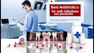 💊 Best Antibiotic for Tooth Infection Not Penicillin | Ampitrexyl Plus Antioxidant Review 💊