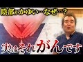 放置すると超危険!症状を見逃されてしまう外陰がんの情報を産婦人科医が解説!