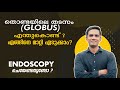   globus    endoscopy  