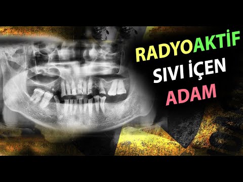 Video: Radyoaktif su içebilir misin?