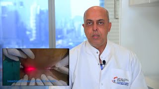 Pilonidal Cyst The Minimally Invasive Laser Solution - Dr. Salil - Laven Clinic