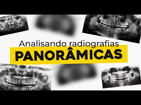 Vídeo: O que é panorâmica panorâmica?