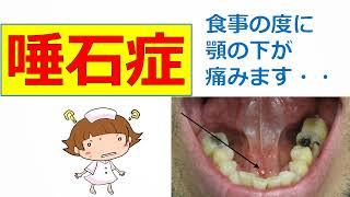 【唾石症】食事の時に顎の下が痛くなります。。。
