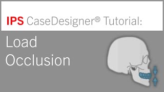 Workflow 3 – Load Occlusion | IPS CaseDesigner® Tutorial