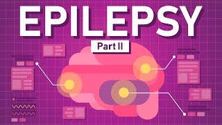 Penyebab Epilepsi dan Cara Mengobatinya?